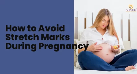 How to Avoid Stretch Marks During Pregnancy