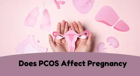 Does PCOS Affect Pregnancy