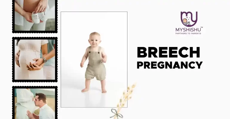 Breech Pregnancy