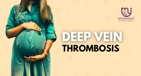 DVT during pregnancy