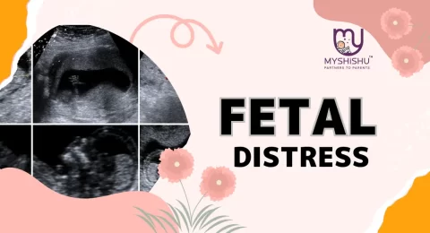 Fetal Distress (NRFS)