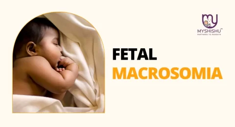 Fetal Macrosomia