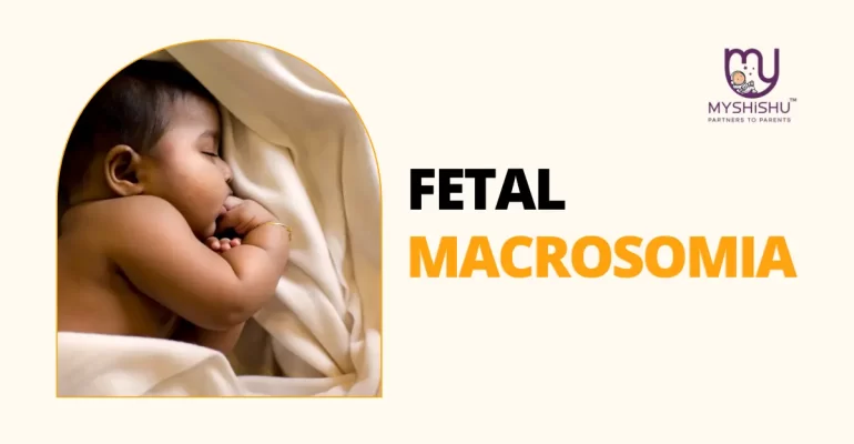 Fetal Macrosomia