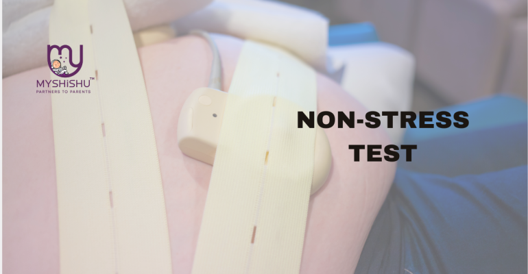 what to expect during a non-stress test