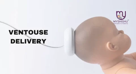 the purpose of ventouse delivery