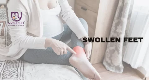 types of swelling during pregnancy