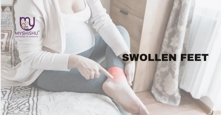 types of swelling during pregnancy