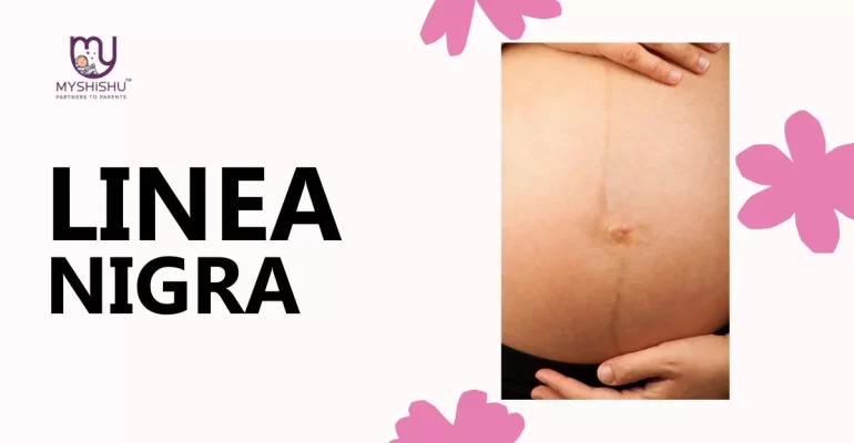 Linea nigra in pregnancy