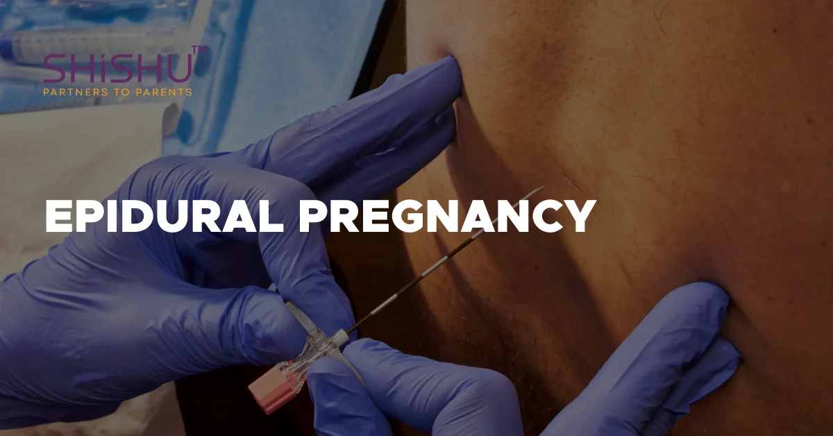 Epidural Pregnancy
